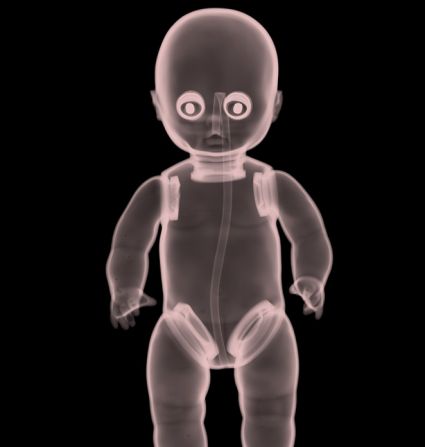 Immagini e Scatti Fotografici a Raggi X di Oggetti Ordinari ed Animali